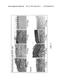 WOUND DRESSING diagram and image