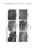 WOUND DRESSING diagram and image