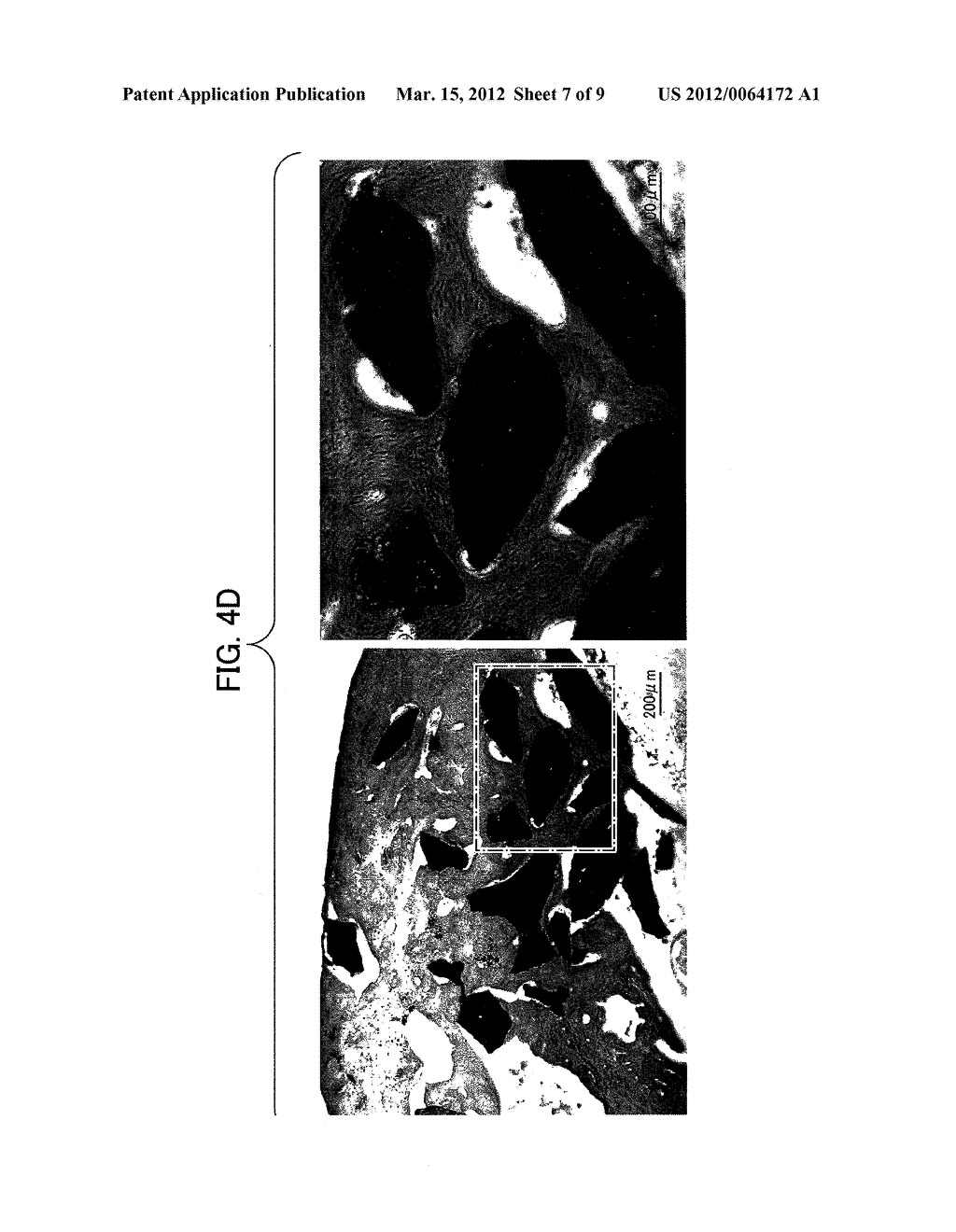 BONE FILLING MATERIAL COMPRISING SINTERED TITANIUM DIOXIDE AND DEXTRIN AND     METHOD FOR RECONSTRUCTING BONE DEFECTS USING THE SAME - diagram, schematic, and image 08