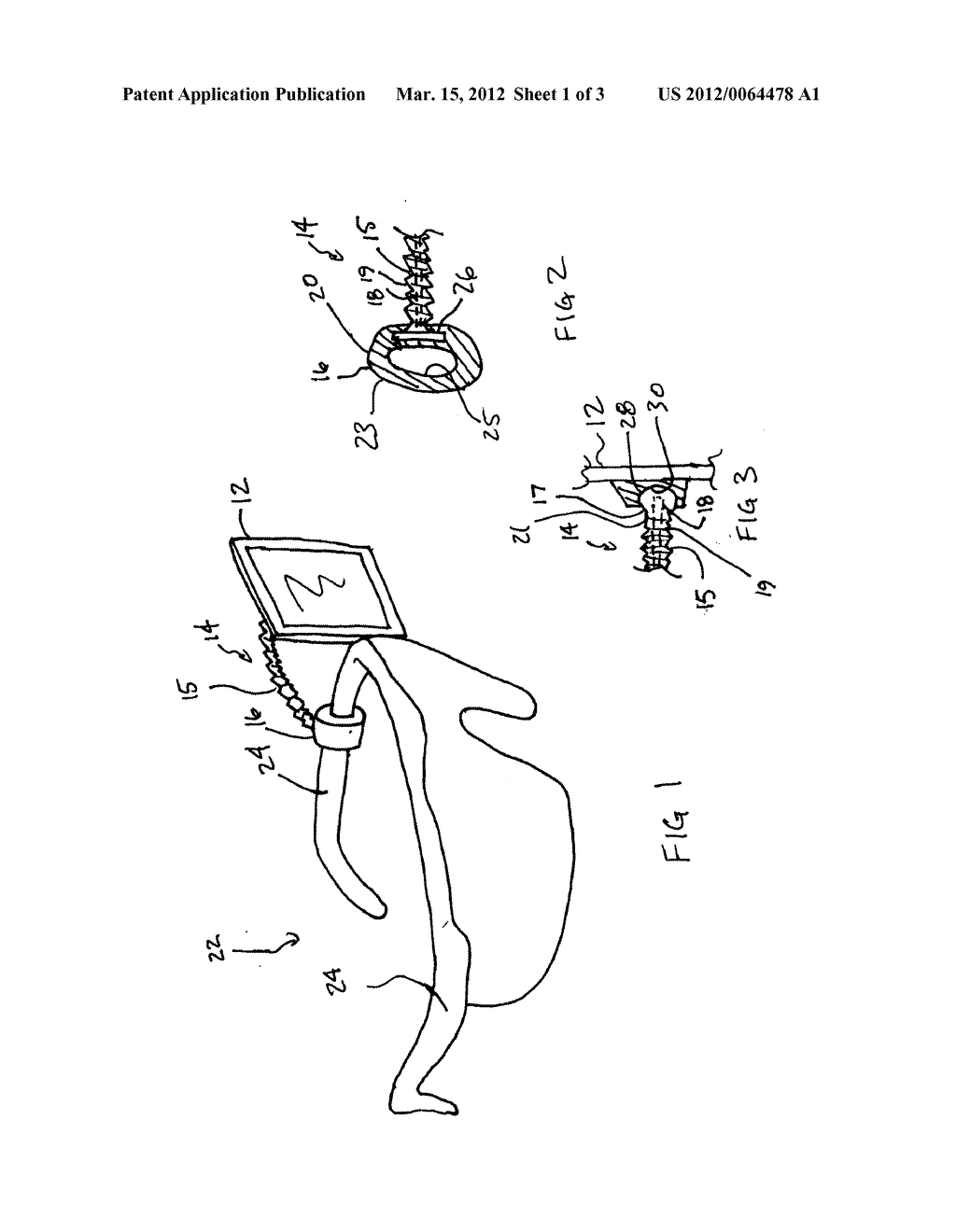 METHOD AND ACCESSORY FOR USE DURING DENTAL PROCEDURE INCLUDING MIRROR FOR     PATIENT - diagram, schematic, and image 02