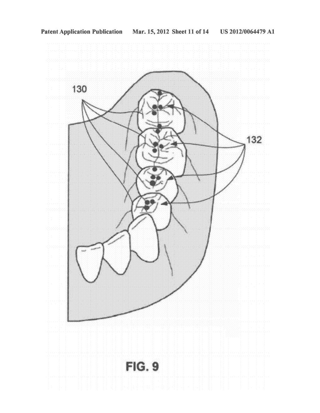 DENTAL RETENTION SYSTEMS - diagram, schematic, and image 12