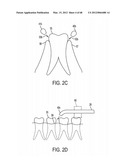 Oral Irrigation and/or Brushing Devices and/or Methods diagram and image