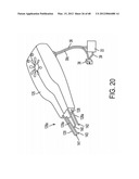 Oral Irrigation and/or Brushing Devices and/or Methods diagram and image