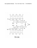 Oral Irrigation and/or Brushing Devices and/or Methods diagram and image