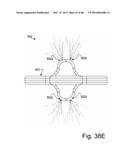 Oral Irrigation and/or Brushing Devices and/or Methods diagram and image