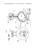 Oral Irrigation and/or Brushing Devices and/or Methods diagram and image