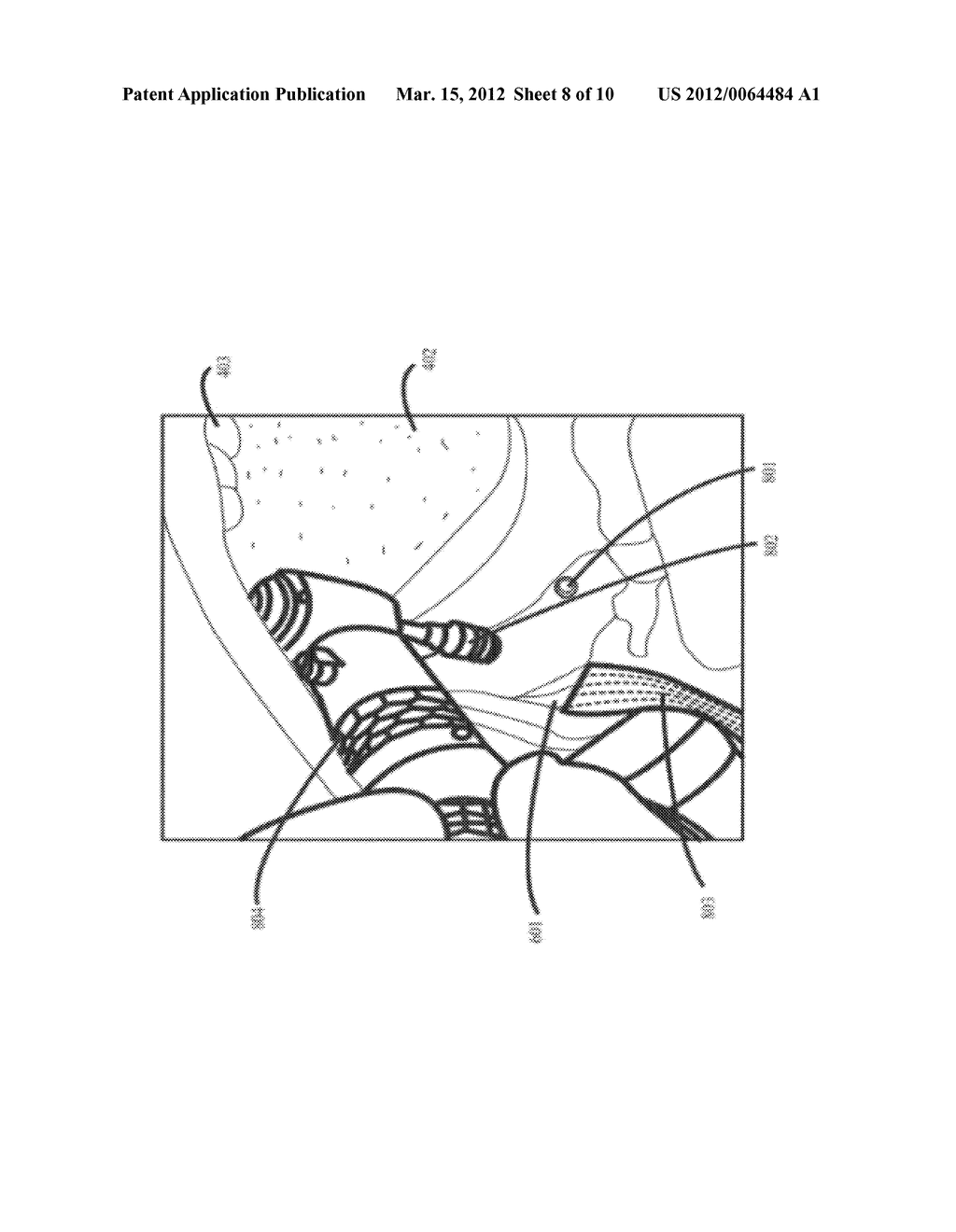 INFERIOR ALVEOLAR NERVE (IAN) PROTECTOR INSTRUMENT - diagram, schematic, and image 09