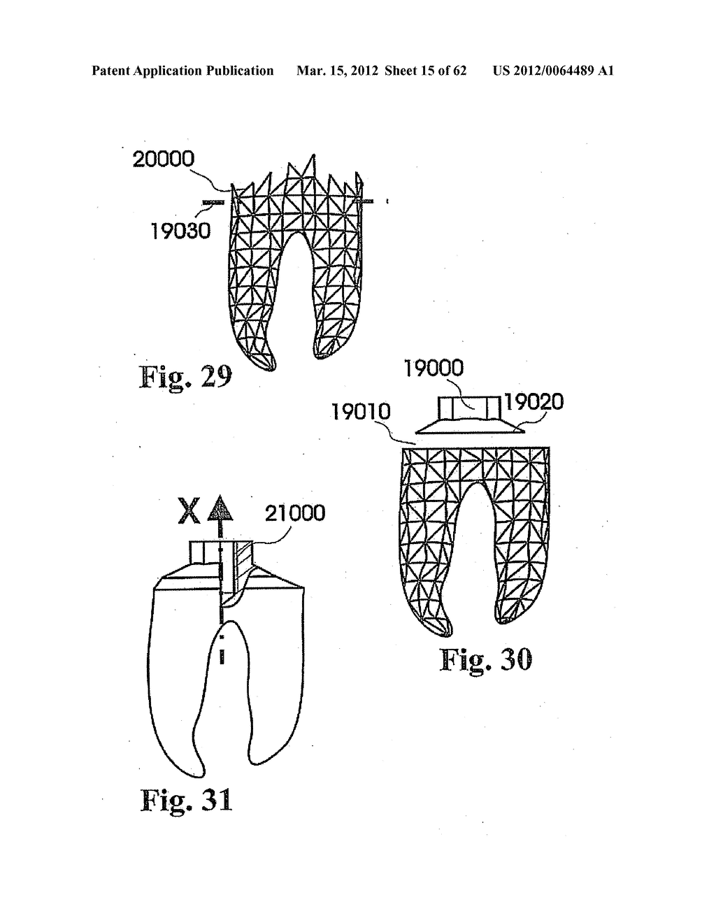 CUSTOMIZED DENTAL PROSTHESIS FOR PERIODONTAL OR OSSEOINTEGRATION AND     RELATED SYSTEMS - diagram, schematic, and image 16