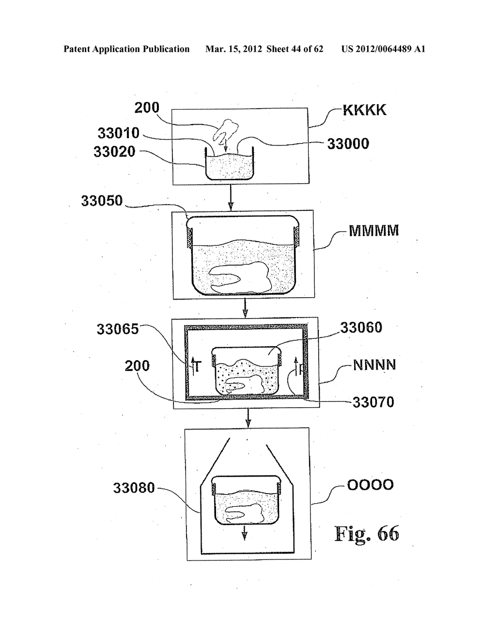 CUSTOMIZED DENTAL PROSTHESIS FOR PERIODONTAL OR OSSEOINTEGRATION AND     RELATED SYSTEMS - diagram, schematic, and image 45