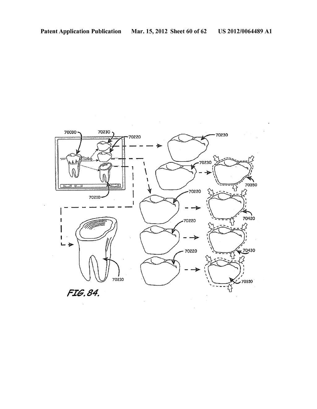 CUSTOMIZED DENTAL PROSTHESIS FOR PERIODONTAL OR OSSEOINTEGRATION AND     RELATED SYSTEMS - diagram, schematic, and image 61