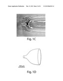 Methods, tip assemblies and kits for introducing material into cells diagram and image