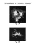 Methods, tip assemblies and kits for introducing material into cells diagram and image