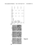 USE OF THE GTPASE RAB27B TO DIAGNOSE AND TREAT POOR PROGNOSIS     ESTROGEN-RECEPTOR-POSITIVE BREAST CANCER diagram and image