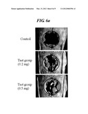 ISOINDOLINONE DERIVATIVES, PREPARATION METHOD THEREOF AND A PHARMACEUTICAL     COMPOSITION COMPRISING SAME diagram and image