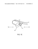 DEVICES AND METHODS FOR DELIVERING SUTURES AND IMPLANTS diagram and image