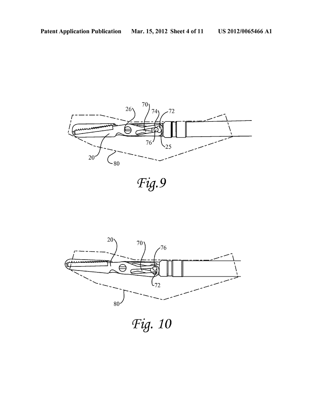 Endoscopic Instrument - diagram, schematic, and image 05