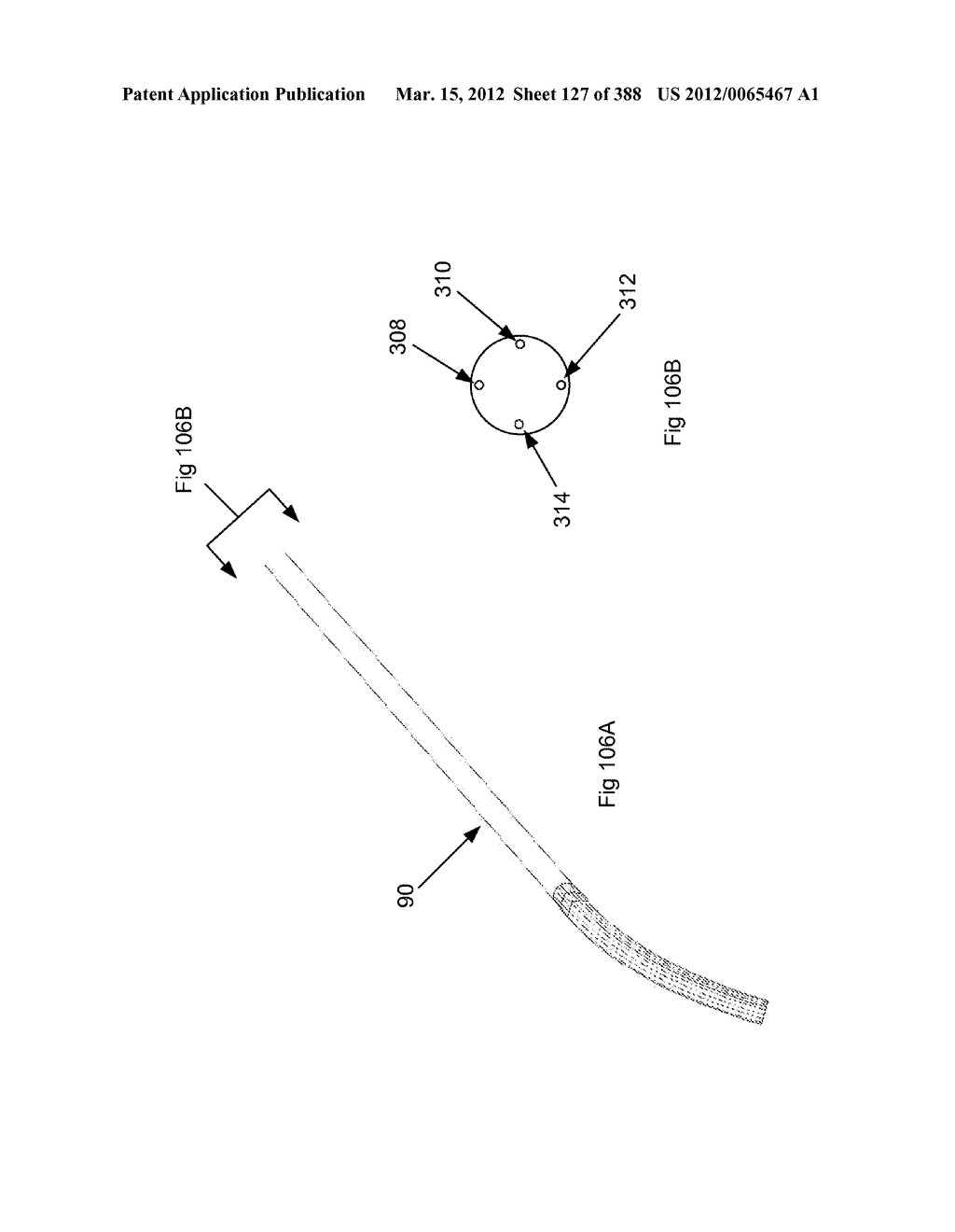 ROBOTIC CATHETER SYSTEM AND METHODS - diagram, schematic, and image 128