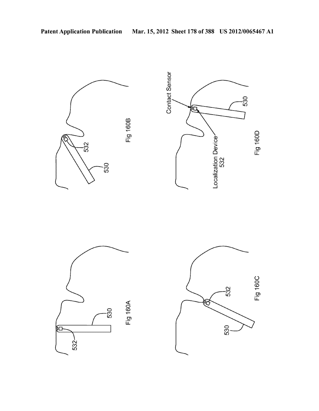 ROBOTIC CATHETER SYSTEM AND METHODS - diagram, schematic, and image 179