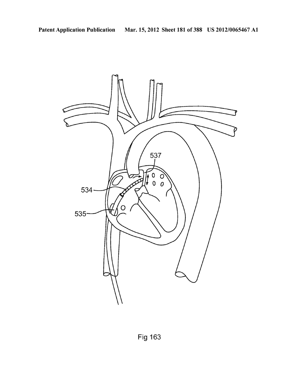 ROBOTIC CATHETER SYSTEM AND METHODS - diagram, schematic, and image 182