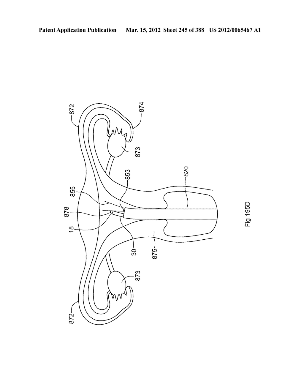 ROBOTIC CATHETER SYSTEM AND METHODS - diagram, schematic, and image 246