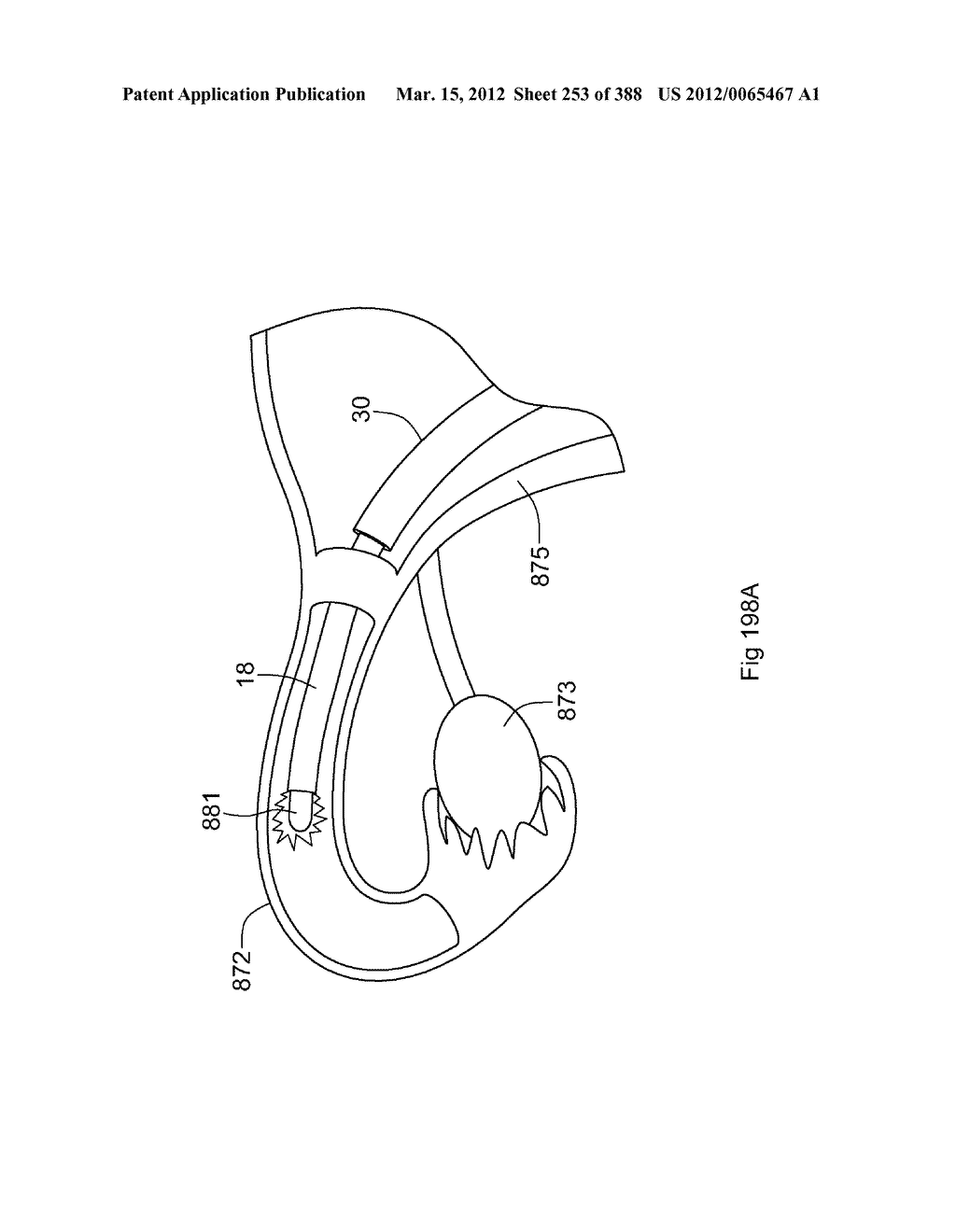 ROBOTIC CATHETER SYSTEM AND METHODS - diagram, schematic, and image 254