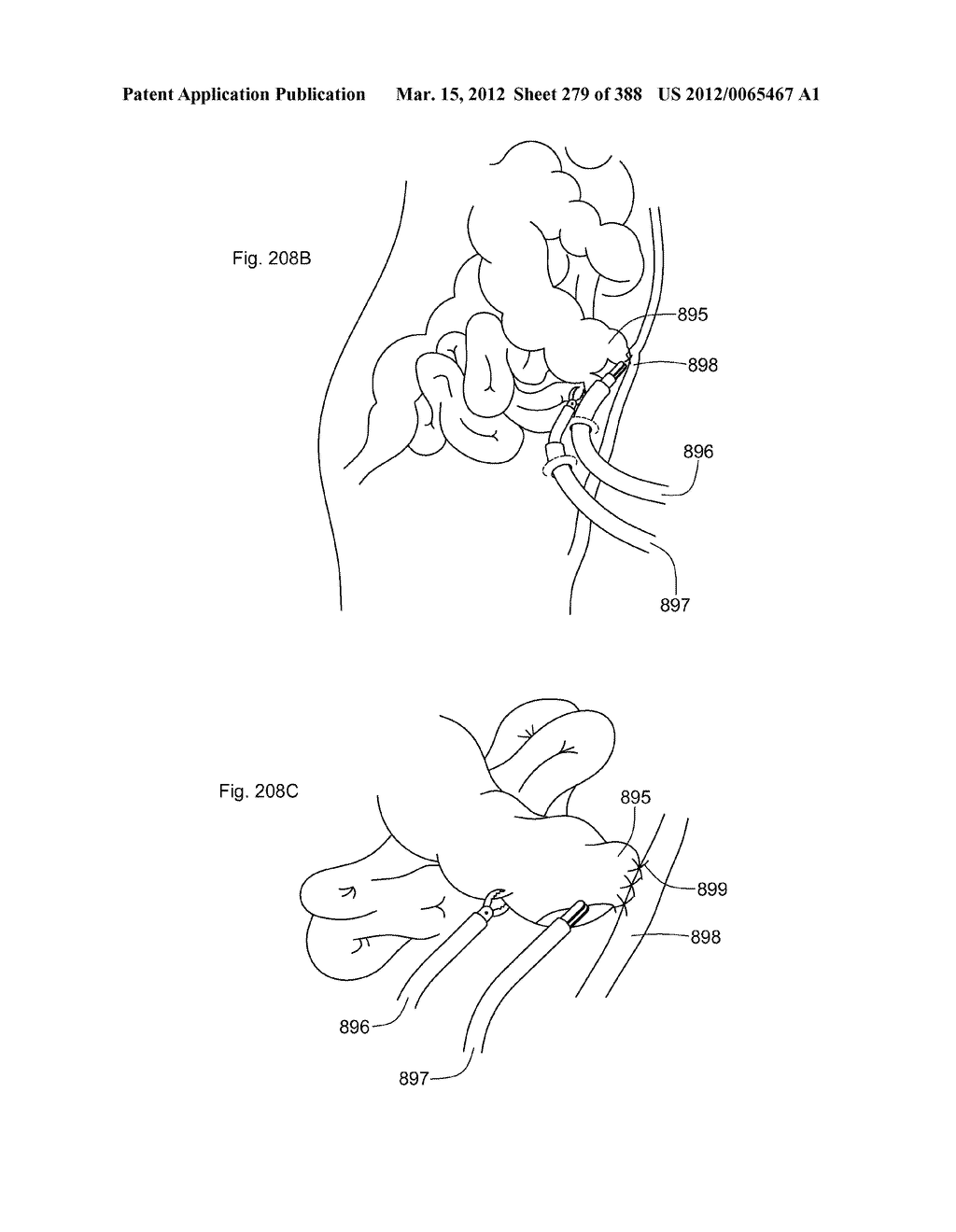 ROBOTIC CATHETER SYSTEM AND METHODS - diagram, schematic, and image 280