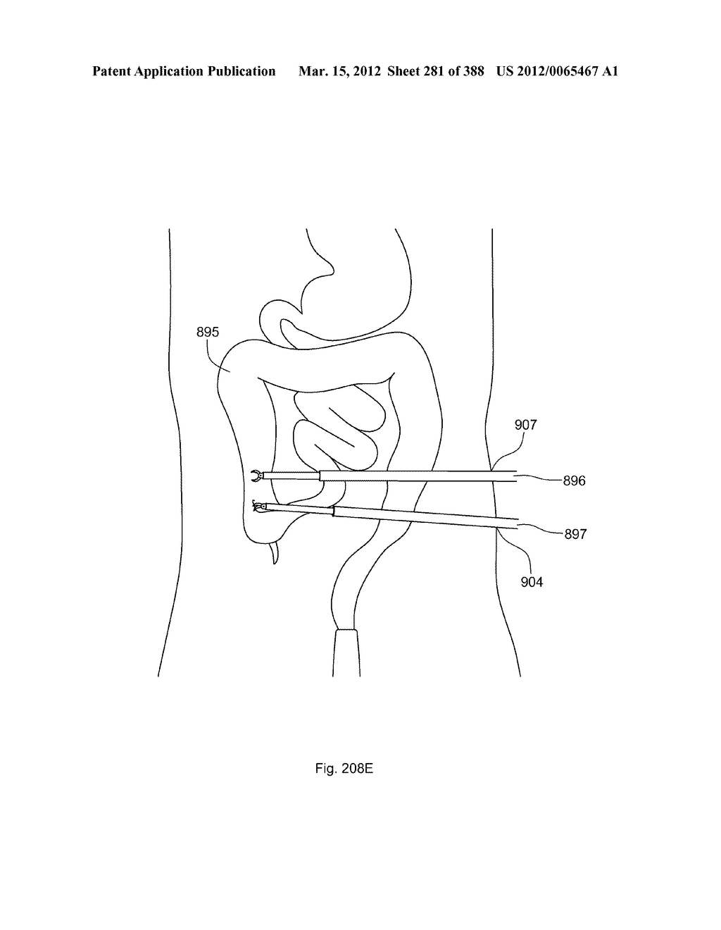 ROBOTIC CATHETER SYSTEM AND METHODS - diagram, schematic, and image 282