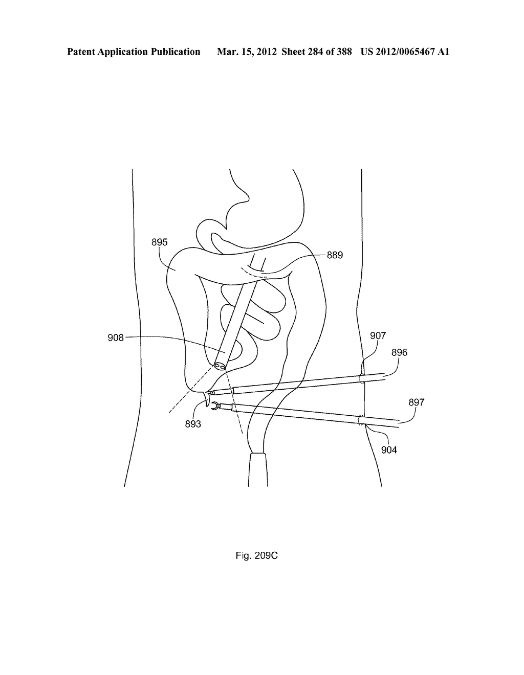 ROBOTIC CATHETER SYSTEM AND METHODS - diagram, schematic, and image 285