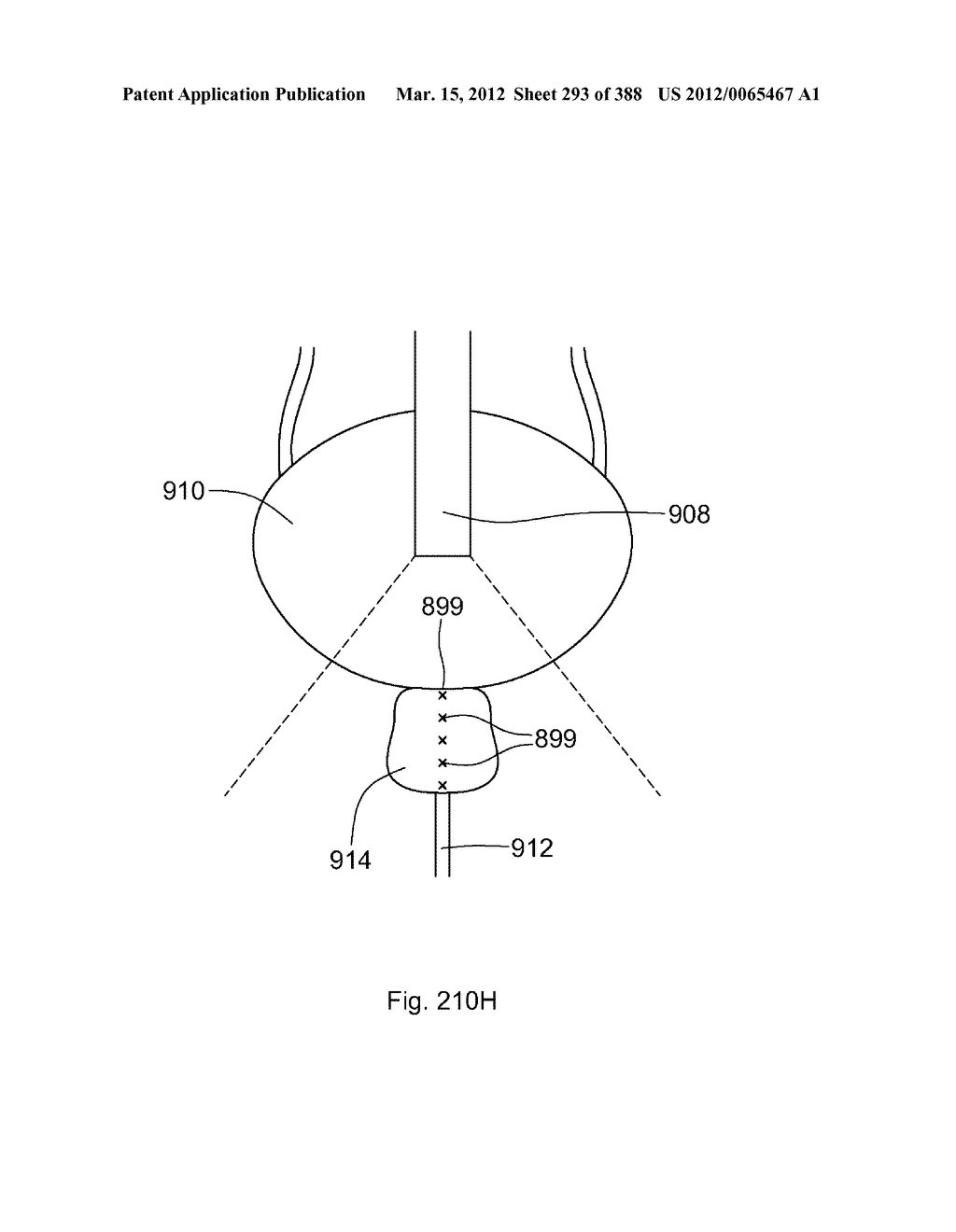 ROBOTIC CATHETER SYSTEM AND METHODS - diagram, schematic, and image 294