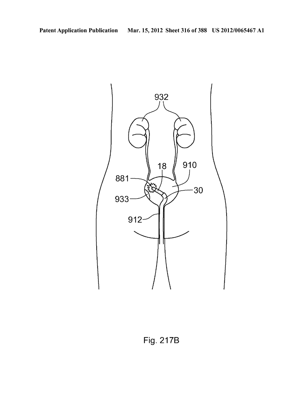 ROBOTIC CATHETER SYSTEM AND METHODS - diagram, schematic, and image 317