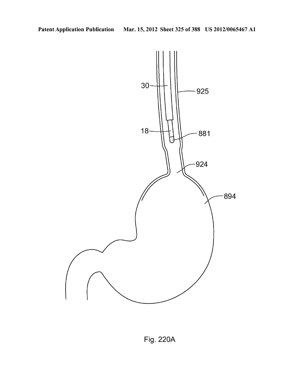 ROBOTIC CATHETER SYSTEM AND METHODS - diagram, schematic, and image 326