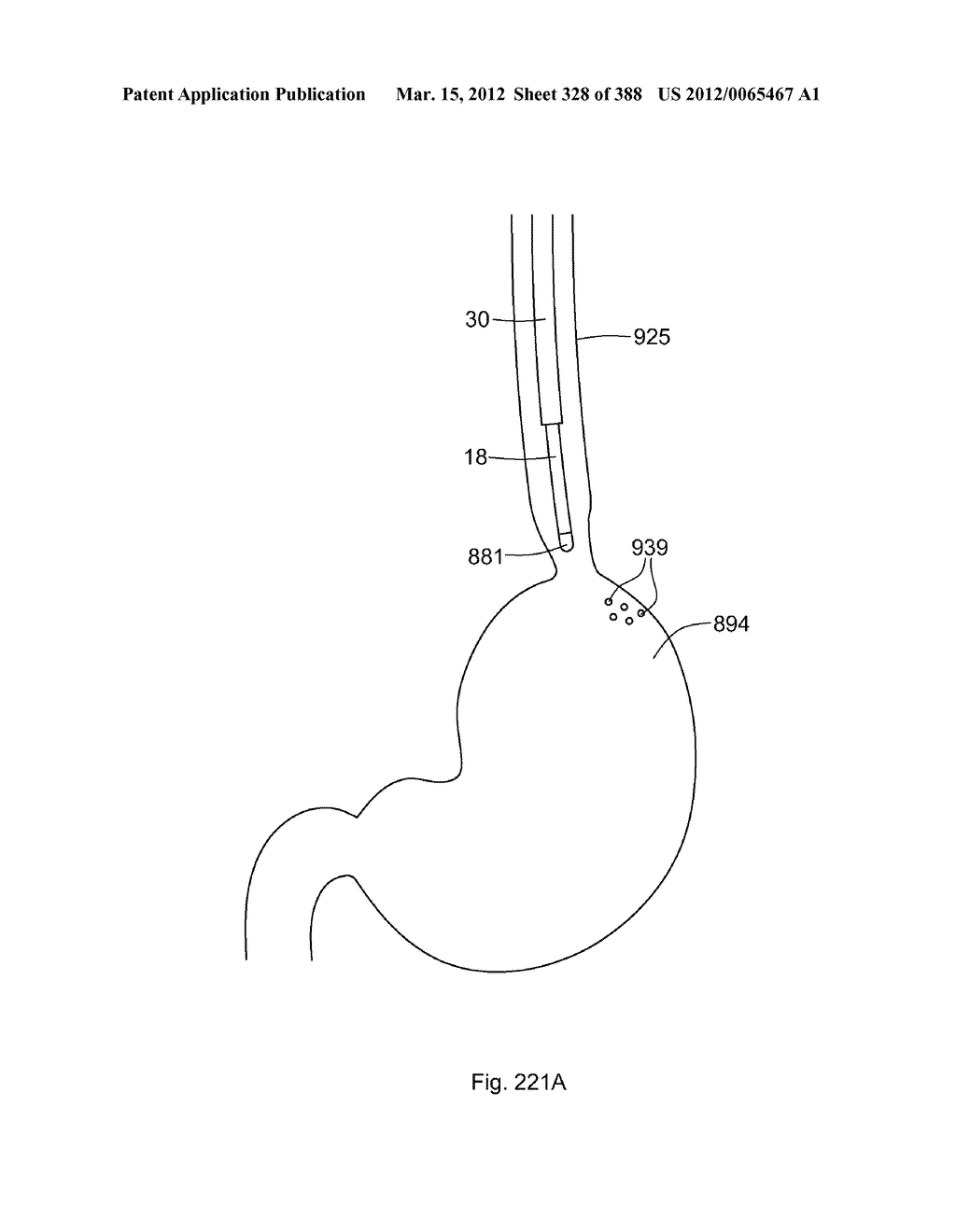 ROBOTIC CATHETER SYSTEM AND METHODS - diagram, schematic, and image 329