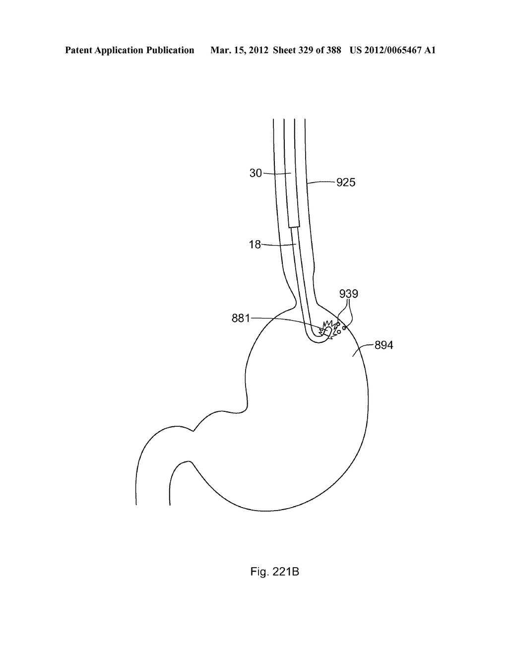 ROBOTIC CATHETER SYSTEM AND METHODS - diagram, schematic, and image 330