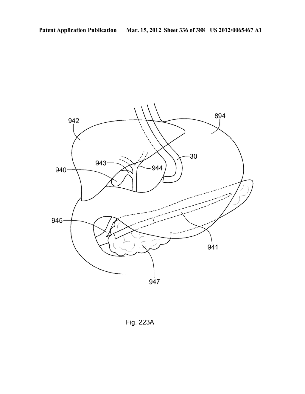 ROBOTIC CATHETER SYSTEM AND METHODS - diagram, schematic, and image 337