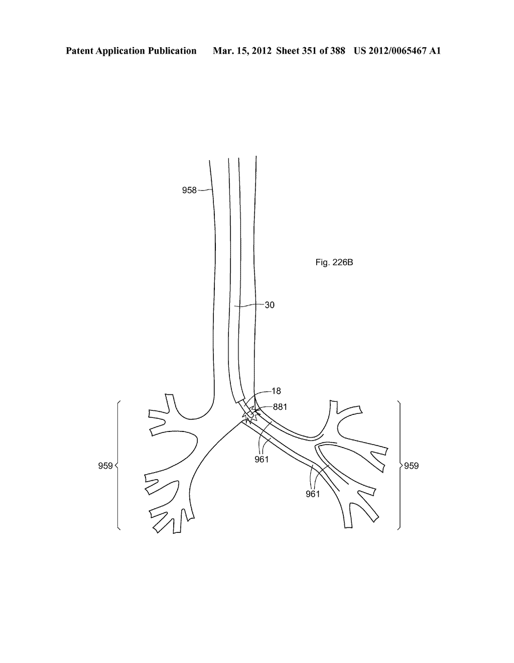 ROBOTIC CATHETER SYSTEM AND METHODS - diagram, schematic, and image 352