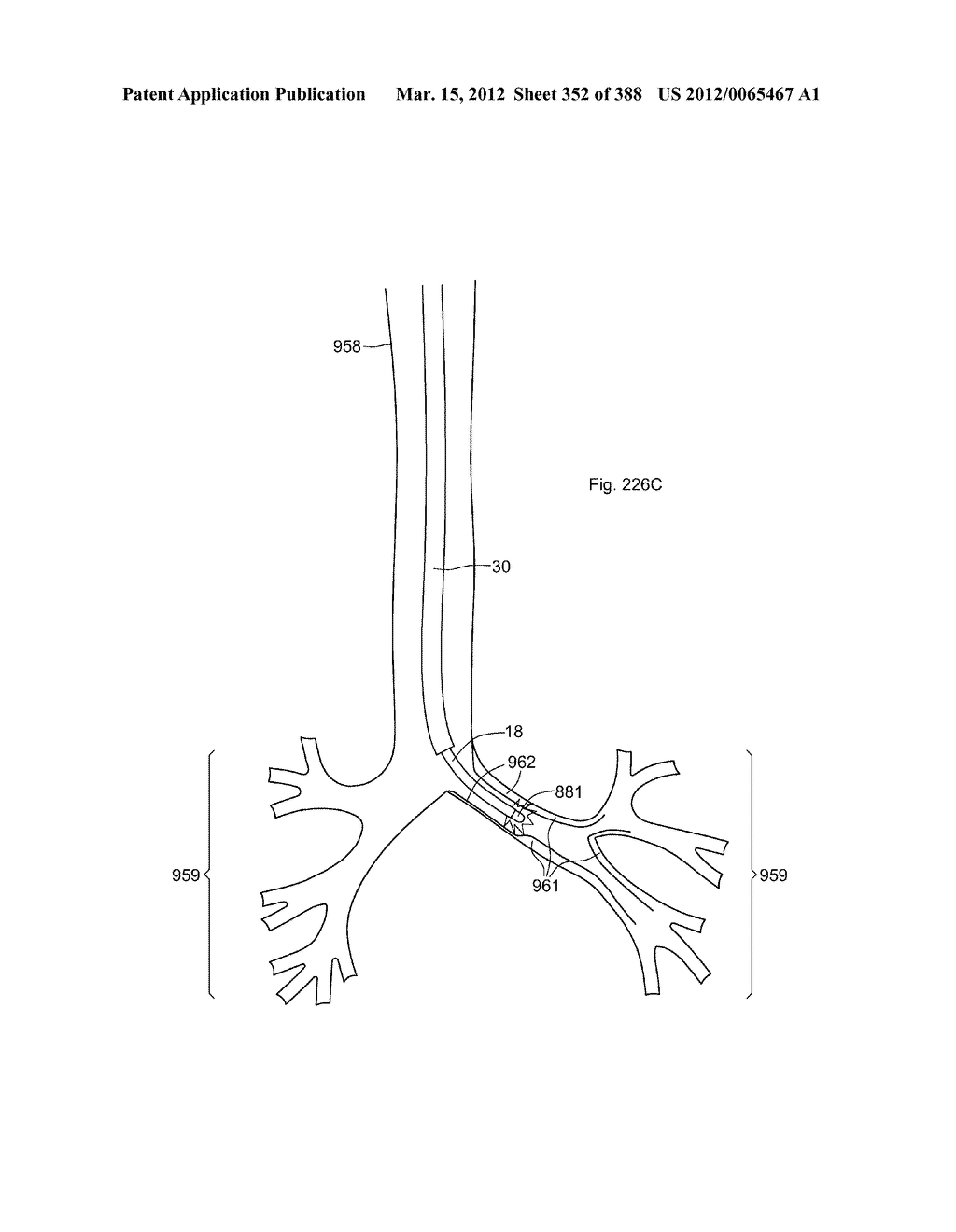 ROBOTIC CATHETER SYSTEM AND METHODS - diagram, schematic, and image 353