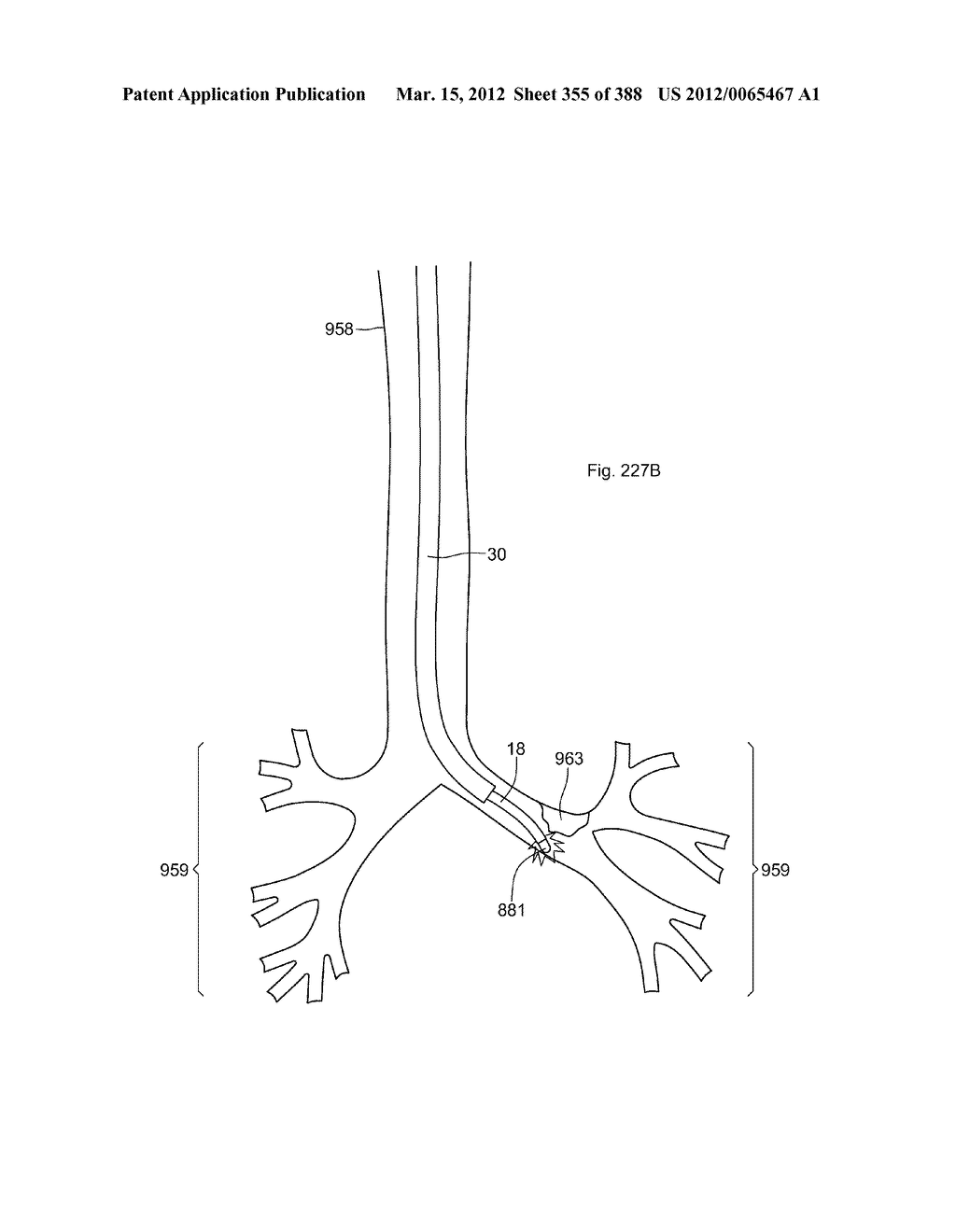 ROBOTIC CATHETER SYSTEM AND METHODS - diagram, schematic, and image 356