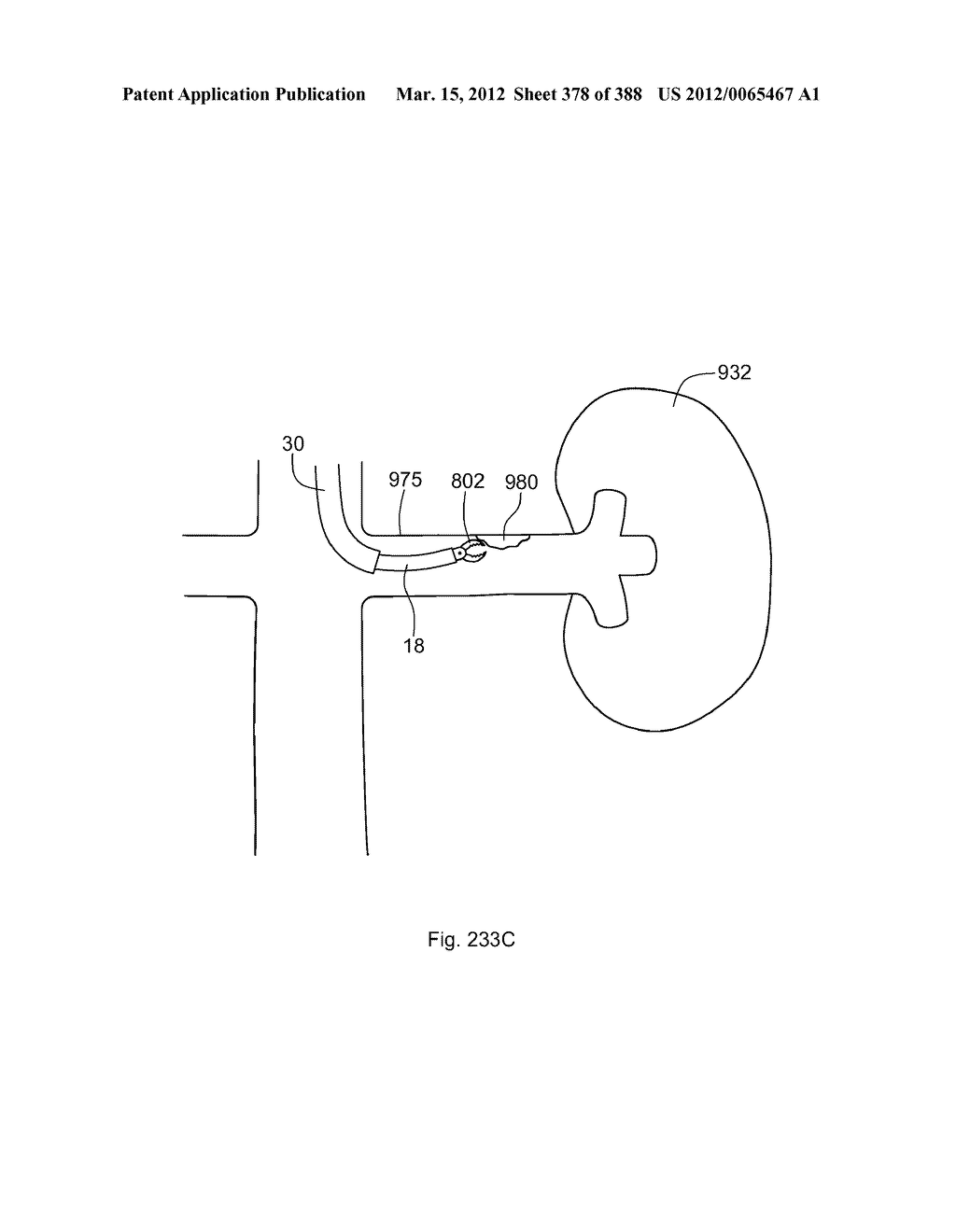 ROBOTIC CATHETER SYSTEM AND METHODS - diagram, schematic, and image 379