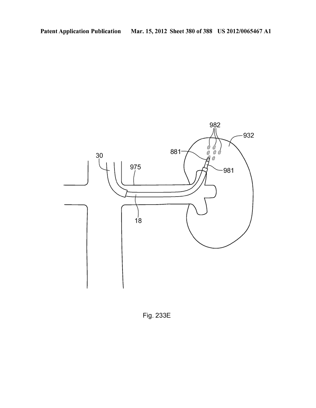 ROBOTIC CATHETER SYSTEM AND METHODS - diagram, schematic, and image 381