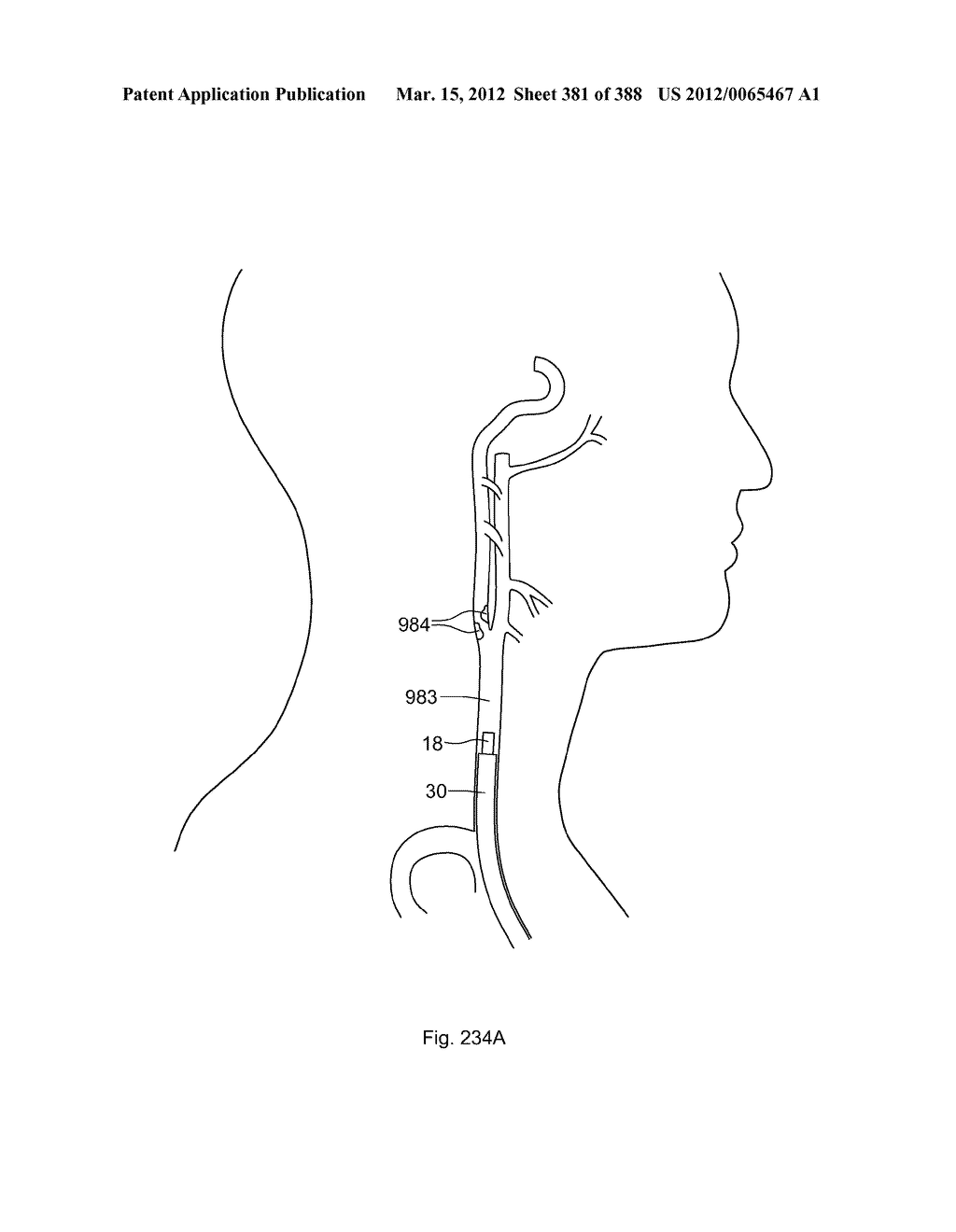 ROBOTIC CATHETER SYSTEM AND METHODS - diagram, schematic, and image 382