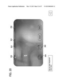 CATHETER WITH IMAGING ASSEMBLY diagram and image