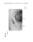 CATHETER WITH IMAGING ASSEMBLY diagram and image