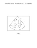 ULTRASOUND SYSTEM AND METHOD FOR CALCULATING QUALITY-OF-FIT diagram and image