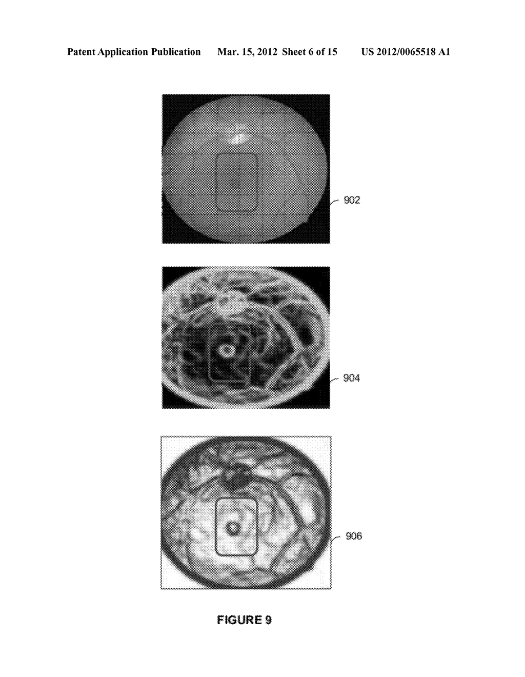 SYSTEMS AND METHODS FOR MULTILAYER IMAGING AND RETINAL INJURY ANALYSIS - diagram, schematic, and image 07