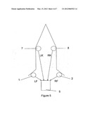 DVT DETECTION diagram and image