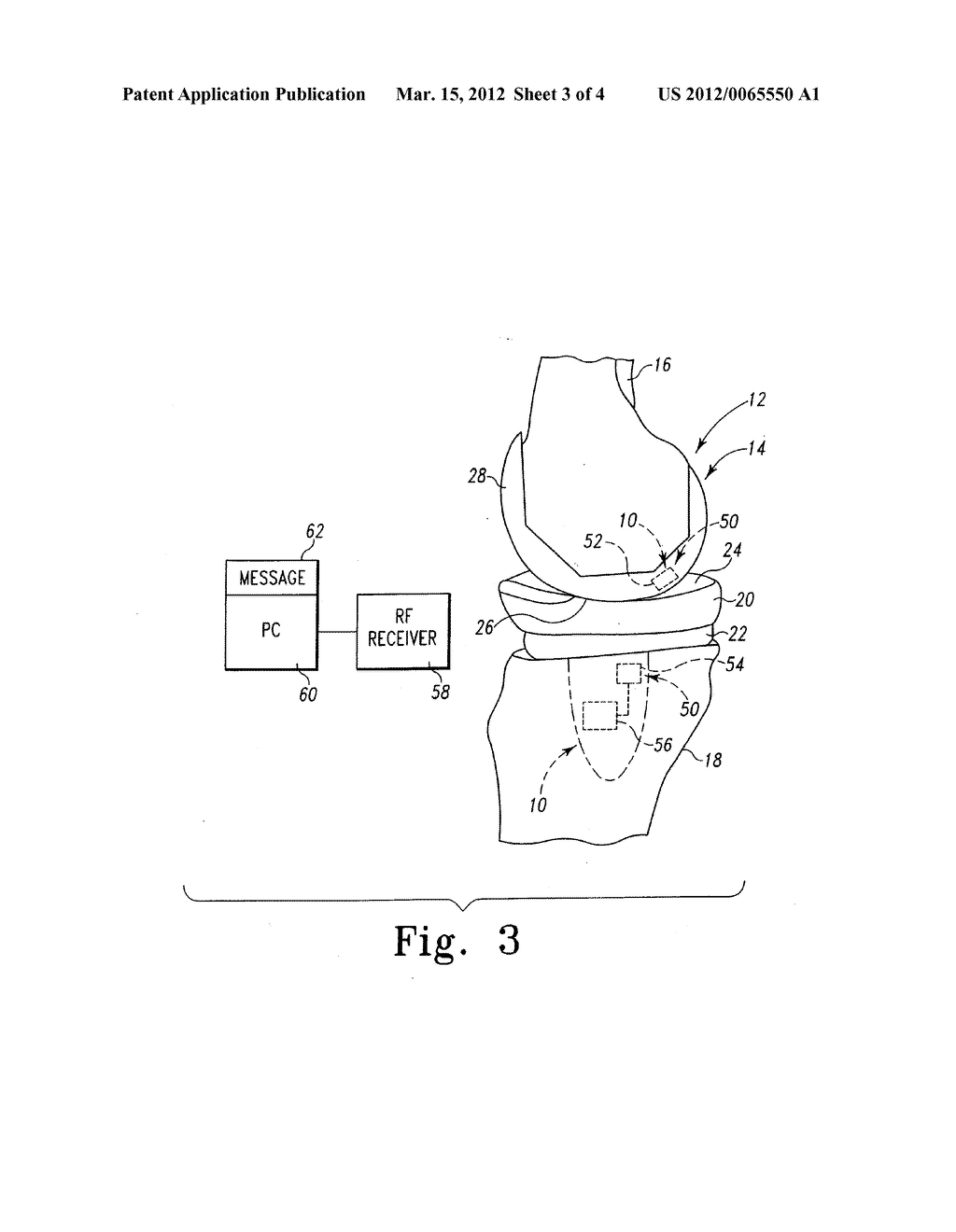 System and Method for Determining Patient Follow-Up Subsequent to an     Orthopaedic Procedure - diagram, schematic, and image 04