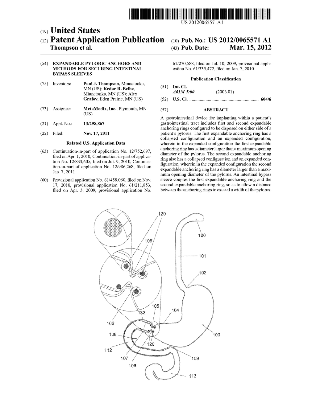 EXPANDABLE PYLORIC ANCHORS AND METHODS FOR SECURING INTESTINAL BYPASS     SLEEVES - diagram, schematic, and image 01