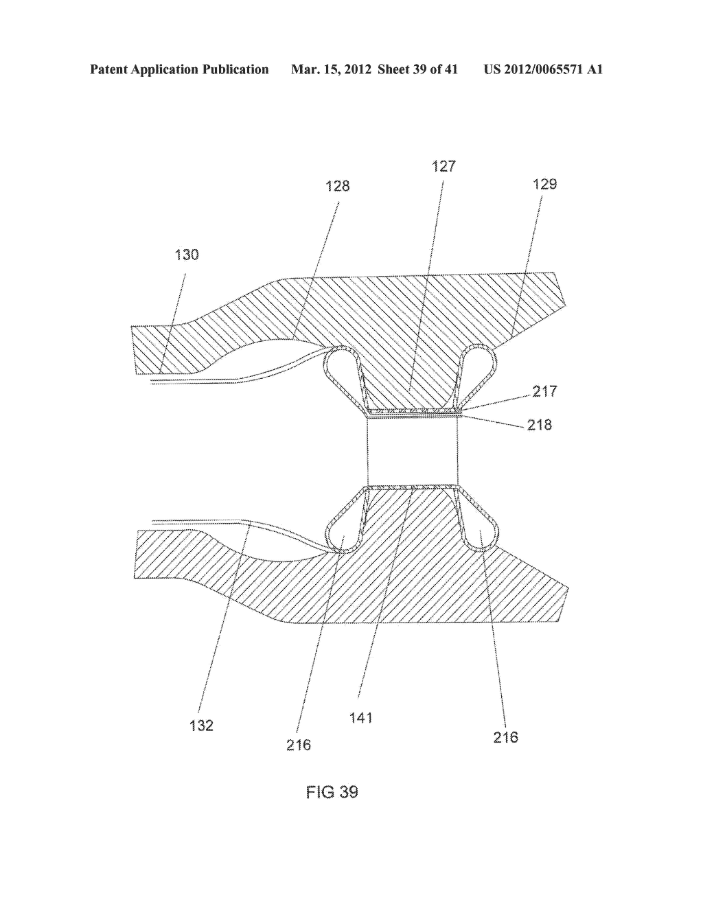 EXPANDABLE PYLORIC ANCHORS AND METHODS FOR SECURING INTESTINAL BYPASS     SLEEVES - diagram, schematic, and image 40