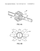 INDWELLING LUMINAL DEVICES diagram and image