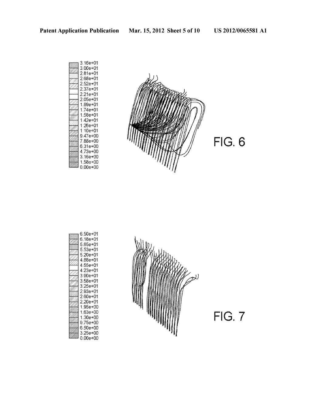 DIALYSIS SYSTEMS AND METHODS INCLUDING CASSETTE WITH AIR REMOVAL - diagram, schematic, and image 06